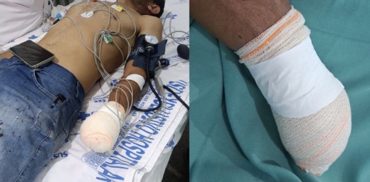 Foto: Divulgação/PM-PI  